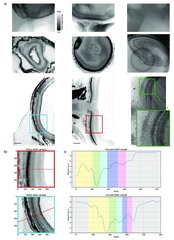 Neodymium acetate as a contrast agent for x-ray phase-contrast ...