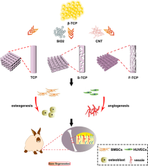 Beta-TCP scaffolds with rationally designed macro-micro ...