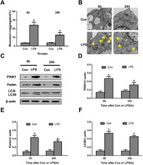 Hydrogen alleviates cell damage and acute lung injury in sepsis ...