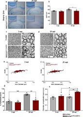 Effects of CIG on the ultrastructure of myelin sheaths and myelinated axons in the corpus callosum