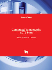 Computed-Tomography (CT) Scan by Reda R. Gharieb (Computed Tomography: Advanced Applications)