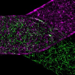 Blood-brain barrier