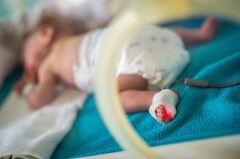 Preemies may have greater risk of premature death as adults, study ...