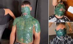 Doctors warn against TikTok trend of covering face with hot WAX ...