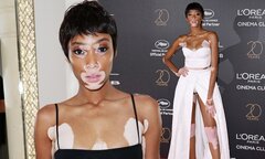 Winnie Harlow