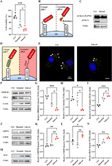 DDRGK1-mediated ER-phagy attenuates acute kidney injury through ER ...