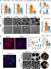 Transcription Factor 4 loss-of-function is associated with ...