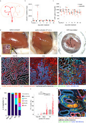 Longitudinal tracking of acute kidney injury reveals injury ...