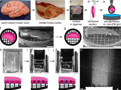 Ultrastructure of human brain tissue vitrified from autopsy ...