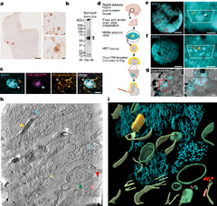 Cryo-electron tomography