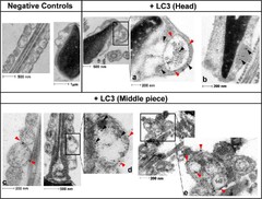 Autophagy-related proteins are functionally active in human ...