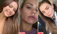 Woman who 'spent hundreds of dollars' on trying to fix skin ...