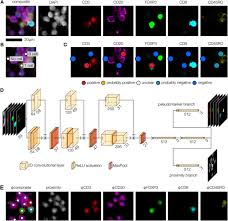 ImmuNet: A Segmentation-Free Machine Learning Pipeline for Immune ...