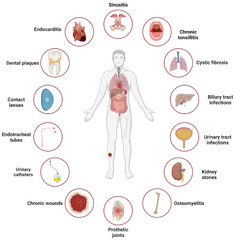 Antibiotics |-Text | Combating Bacterial Biofilms ...