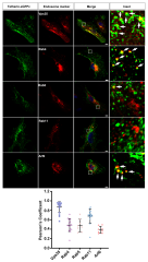 Cells |-Text | Parkinson's Disease Causative Mutation in ...