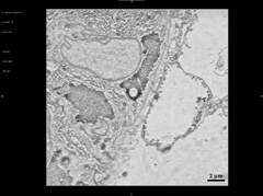 Human pluripotent stem cell-derived kidney organoids for ...