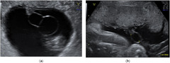 Diagnostics |-Text | Clinically Relevant Prenatal ...