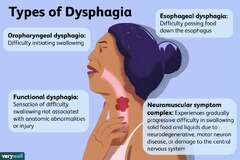 Cause of Functional Dysphagia: Anxiety, Depression, and More