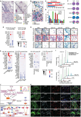 Cellular and molecular heterogeneities and signatures, and ...