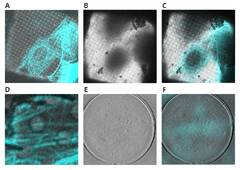 Introducing cryo-electron tomography - CRYO