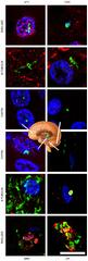 Frontiers | Fungal Enolase, β-Tubulin, and Chitin Are Detected in ...