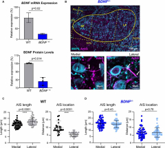 Frontiers | Brain-Derived Neurotrophic Factor Is Involved in ...