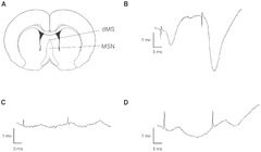 IJMS |-Text | Deep Brain Stimulation of the Medial ...