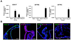 Human pluripotent stem cell-derived alveolar organoid with macrophages