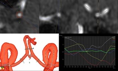 Molecular mechanisms of phase separation and amyloidosis of ALS ...