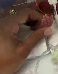 Long Island premature baby, Shyne Graham, born less than 2 pounds ...