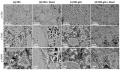 JFB |-Text | Calcium Phosphate Cements Combined with ...