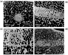 JFB |-Text | Calcium Phosphate Cements Combined with ...