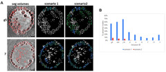 Life |-Text | Single Cell Cryo-Soft X-ray Tomography ...