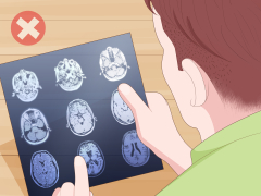 Cara Membaca MRI: 15 Langkah (dengan Gambar) - wikiHow