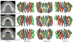 ToothNet: Automatic Tooth Instance Segmentation and Identification ...