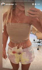 Tamra Judge Shares Post-Op Photos After Breast Implant Removal