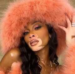 Winnie Harlow